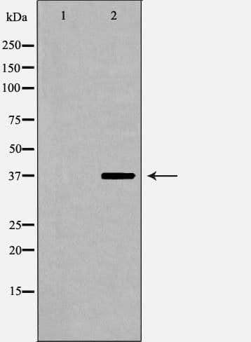 CFHR1 Antibody