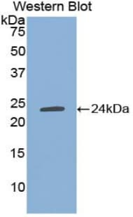TIMP1 Antibody (aa25-207)