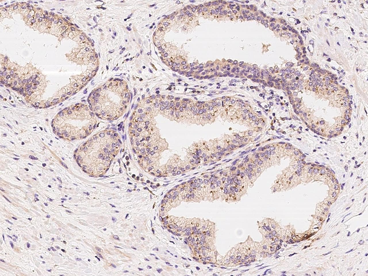 NAA10 / ARD1A Antibody (Preservative Free)