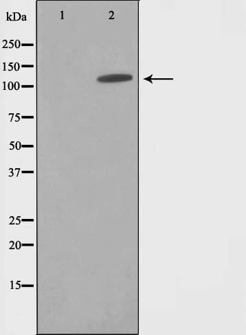 SUPT16H / FACTP140 Antibody