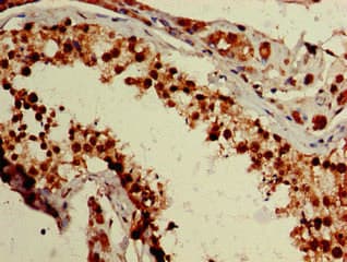 Polyclonal Rabbit anti-Human ZNF331 Antibody (aa179-442, IHC, IF)