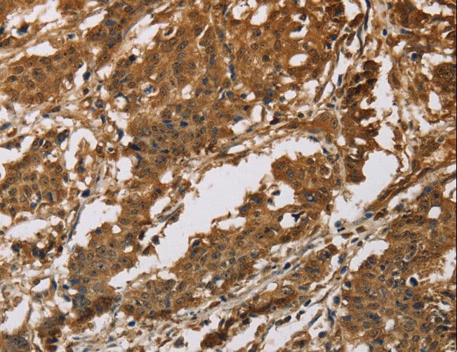 IHC-plus™ IL19 Antibody (aa39-52)