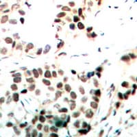 MYC / c-Myc Antibody (C-Terminus)