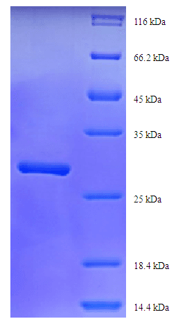 Trichosanthes kirilowii Alpha-Trichosanthin Protein (Recombinant His)
