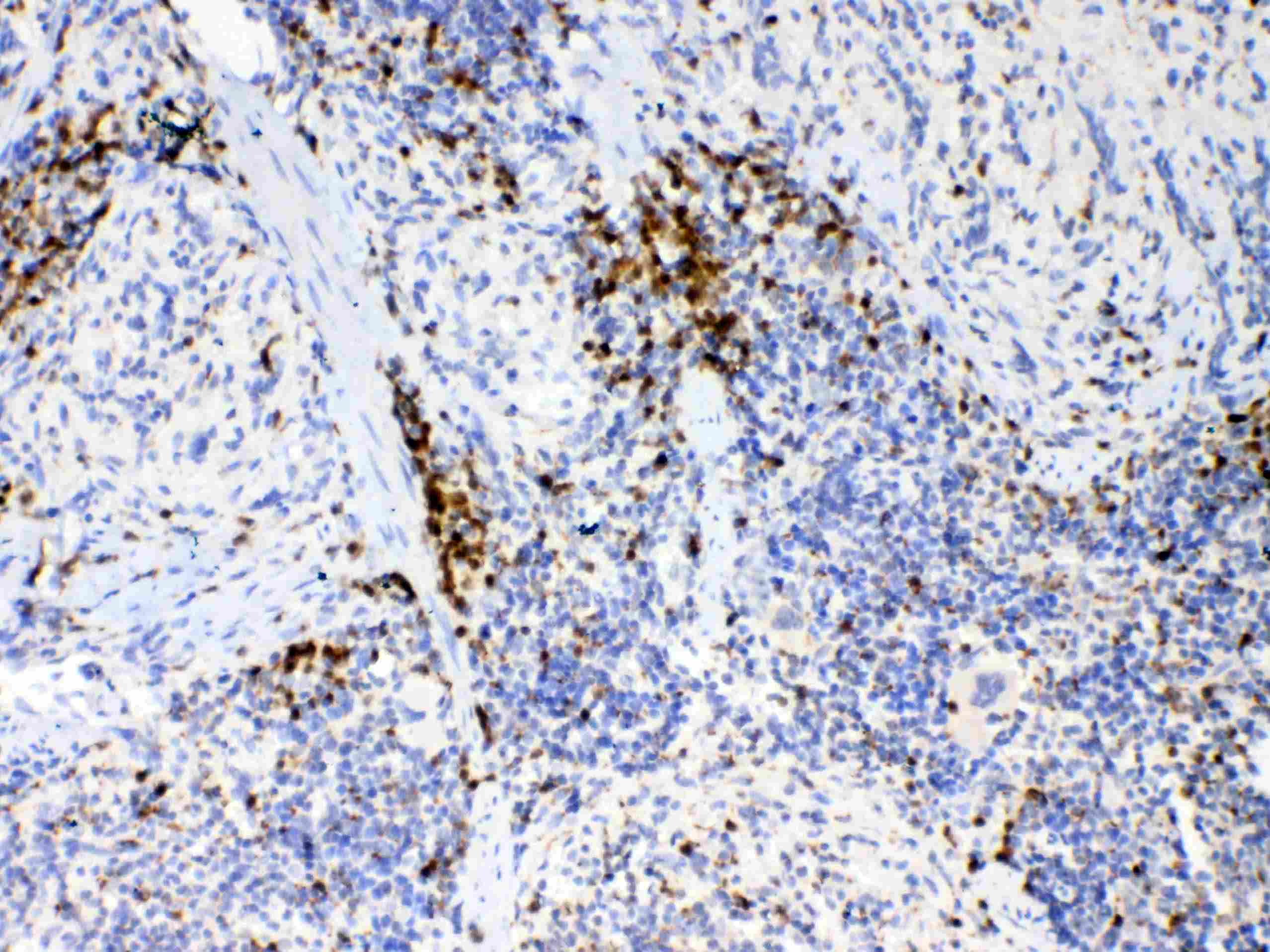 IL17A Antibody
