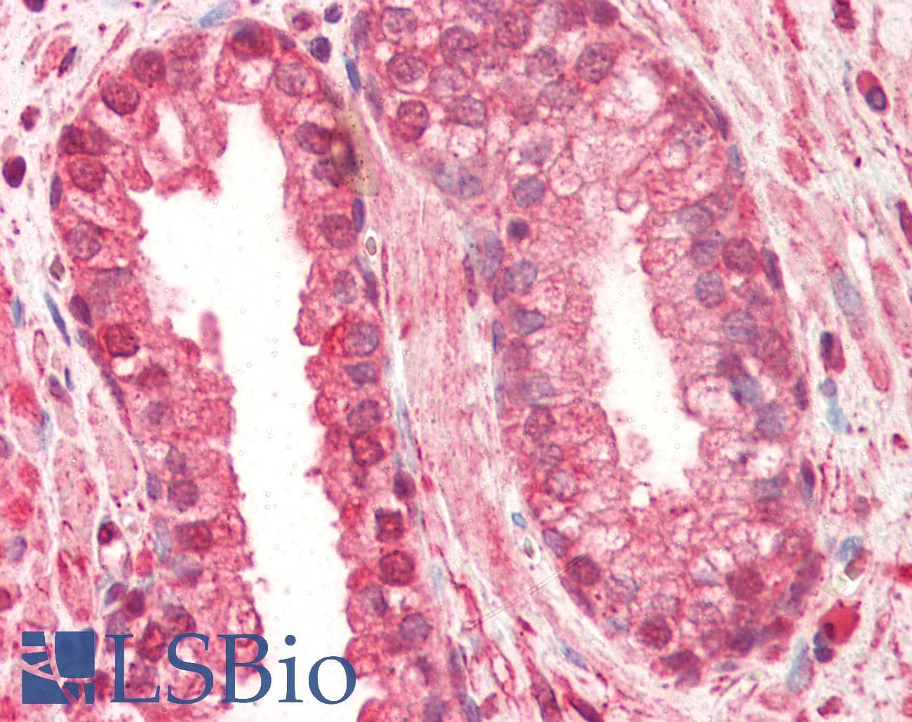 IHC-plus™ Monoclonal Mouse anti-Human CTSL / Cathepsin L Antibody (clone 2H7, aa114-333, IHC, WB)