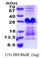 Human PRH1 Protein (Recombinant His)