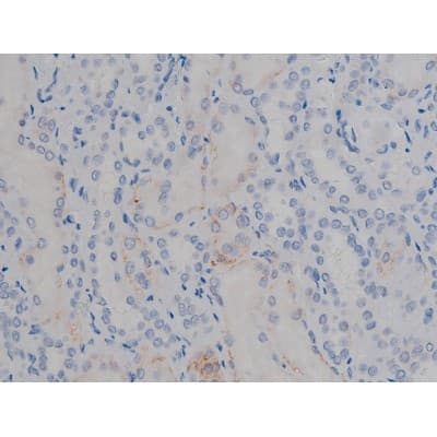 MAPT / Tau Antibody (phospho-Ser356)