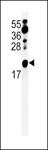 Polyclonal Rabbit anti-Human CNBP / ZNF9 Antibody (aa67-96, IHC, WB)