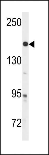IHC-plus™ Polyclonal Rabbit anti-Human ABL Antibody (Tyr251, IHC, WB)