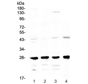 Polyclonal Rabbit anti-Mouse GSTM1 Antibody (WB)
