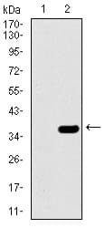 SLC27A5 / BACS Antibody (aa508-570, clone 4B11C10)
