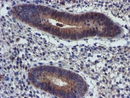 PIH1D2 Antibody (clone OTI4A10)