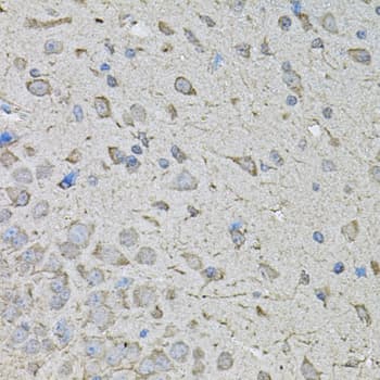 Polyclonal Rabbit anti-Human CDK10 Antibody (IHC, WB)