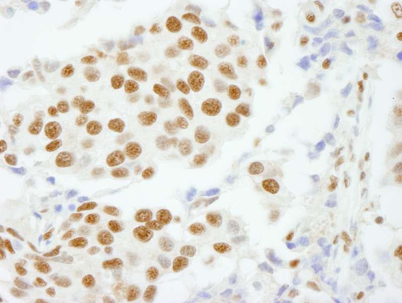 Polyclonal Rabbit anti-Human CPSF160 / CPSF1 Antibody (aa1392-1442, IHC, IF)