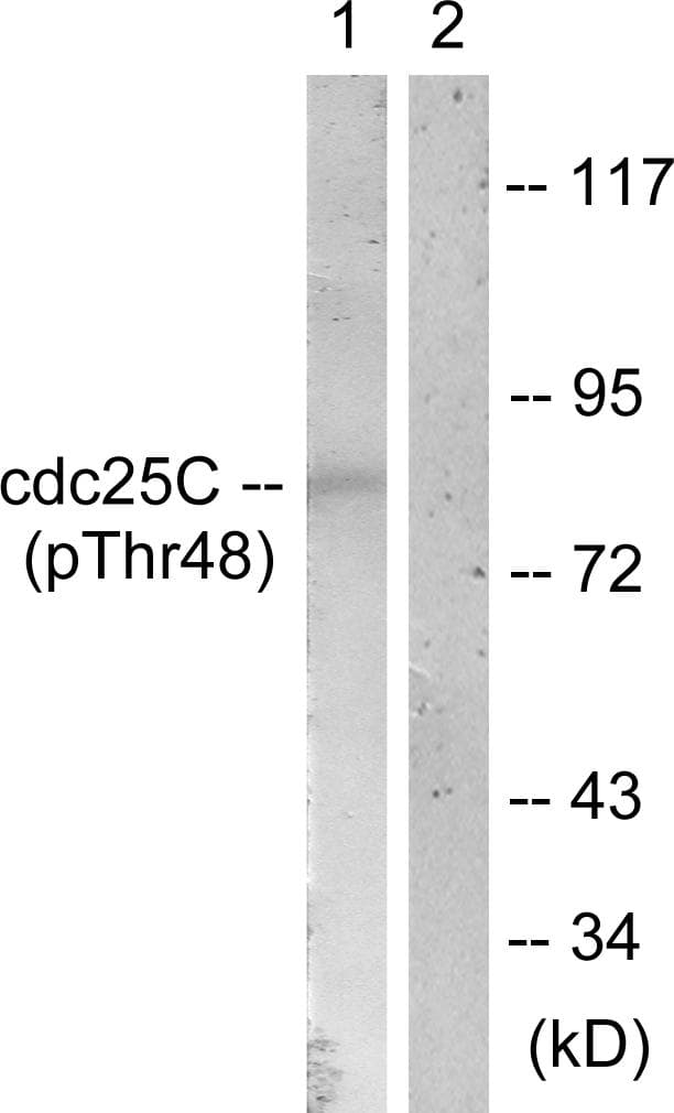 Polyclonal Rabbit anti-Human CDC25C Antibody (phospho-Thr48, IHC, WB)