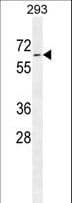 PLD5 / Phospholipase D5 Antibody (aa508-536)