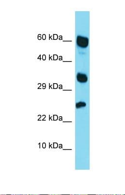 RARRES1 Antibody (aa126-175)