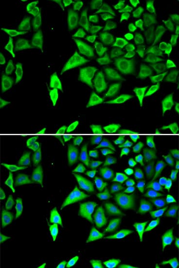 NPPA / ANP Antibody