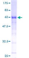 Human RPRD1B Protein (Recombinant GST)