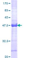 Human CHD4 Protein (Recombinant GST, N-terminus)