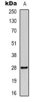 IHC-plus™ YWHAZ / 14-3-3 Zeta Antibody (Acetyl-Lys51/49)