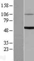 UGT1A6 Protein (Over-Expression Lysate Myc-DDK (Flag))