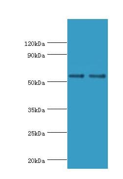 Polyclonal Rabbit anti-Human SLC2A1 / GLUT-1 Antibody (aa210-310, IHC, WB)