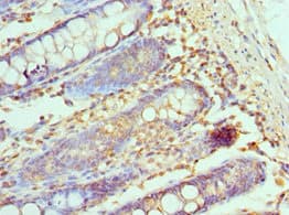 CCL28 / MEC Antibody (aa20-127)