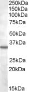 B1R / BDKRB1 Antibody (aa322-333)