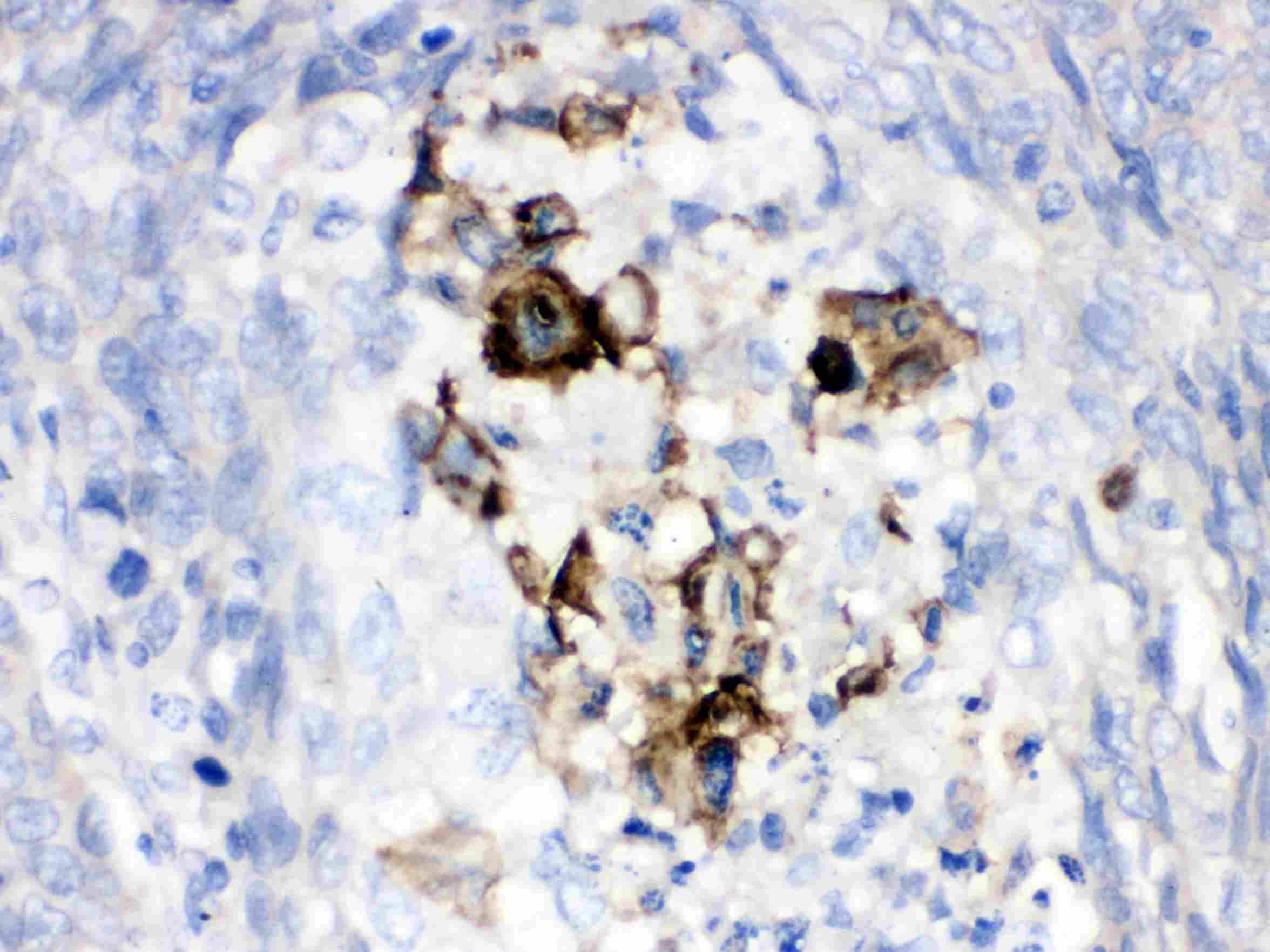 CFB / Complement Factor B Antibody