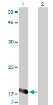NUDT2 Antibody (clone 4A4-3C3)