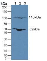 NUP210 / gp210 Antibody (aa1288-1449)
