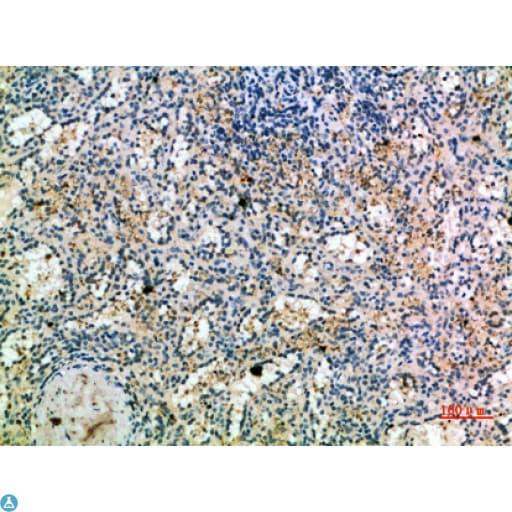 Polyclonal Rabbit anti-Human CCR1 Antibody (IHC)