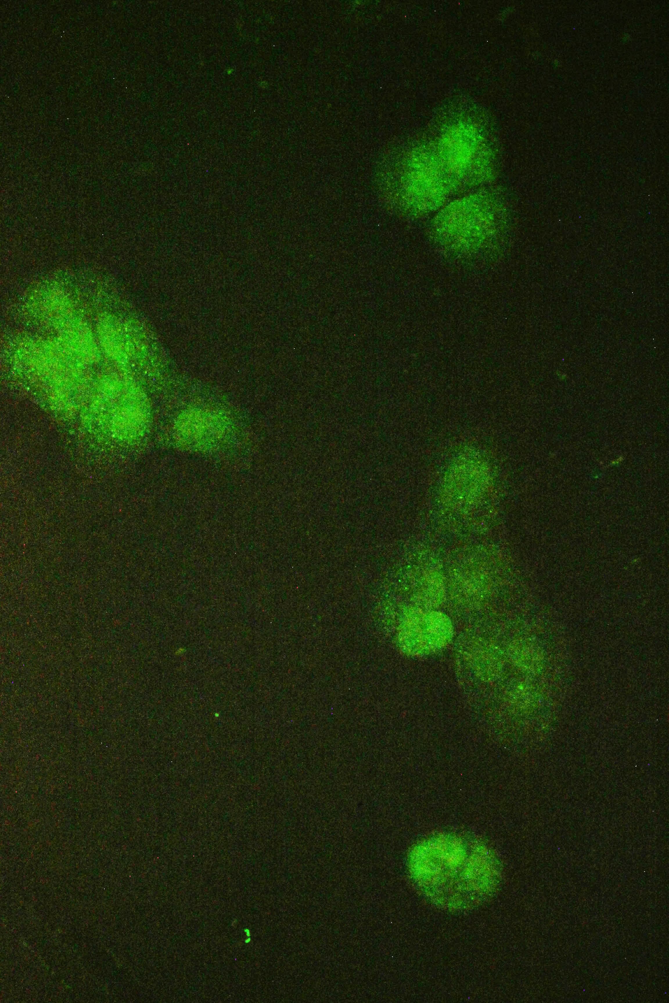 Polyclonal Rabbit anti-Human SMC6 Antibody (WB)