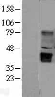 WNT5B Protein (Over-Expression Lysate Myc-DDK (Flag))