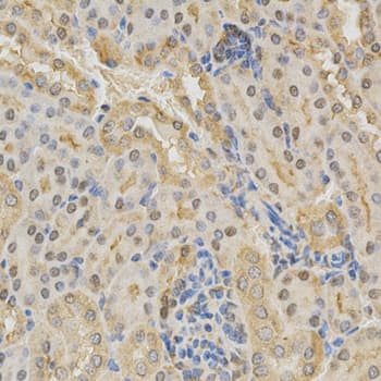 Polyclonal Rabbit anti-Human ADD1 / Adducin Alpha Antibody (IHC, WB)
