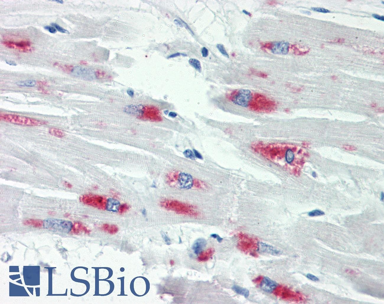 IHC-plus™ Polyclonal Rabbit anti-Human SMAD2+3 Antibody (aa1-50, IHC, WB)