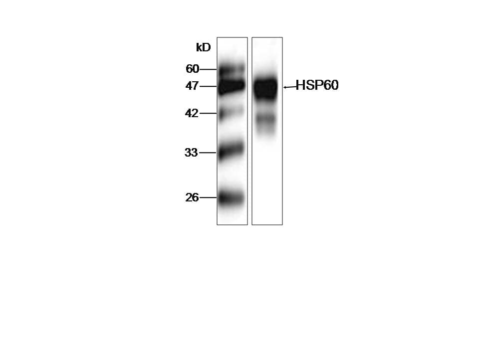 Monoclonal Mouse anti-Legionella pneumophila Legionella pneumophila groL Antibody (clone 59533-18, aa72-478, WB)