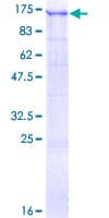 Human USP1 Protein (Recombinant GST)