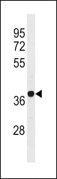 Polyclonal Rabbit anti-Mouse CAMK1D Antibody (aa39-67, WB)