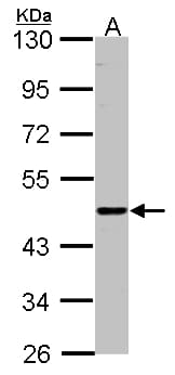 ENTPD6 Antibody (aa114-285)