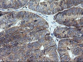 UBE2G2 Antibody (clone OTI1D7)