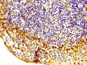 MASTL / GW Antibody