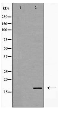 STMN1 / Stathmin / LAG Antibody (phospho-Ser24)
