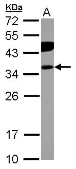 Polyclonal Rabbit anti-Human PITPNB Antibody (IHC, WB)