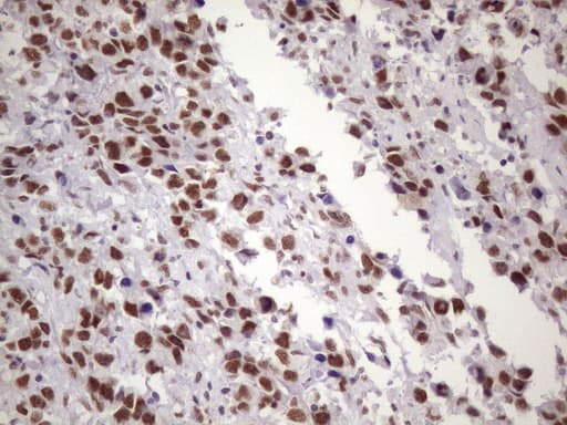 NUDT21 Antibody (aa2-227, clone OTI1B1)
