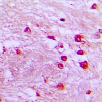 CDK5R2 Antibody (Internal)