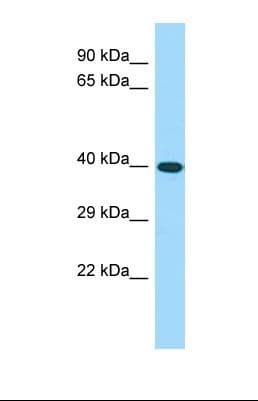 CWC25 Antibody (aa308-357)