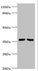 Polyclonal Rabbit anti-Human WDR77 / MEP50 Antibody (aa1-260, IHC, WB)